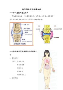 类风湿关节炎健康宣教模板