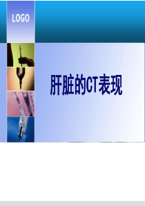 肝脏的CT影像诊断(最全版PPT)