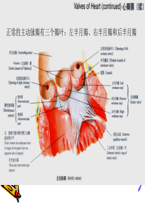 主动脉狭窄护理