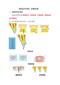 瓷贴面修复的操作事项