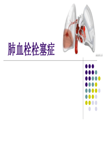 西医内科培训课件-肺栓塞