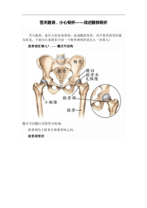 雪天路滑,小心骨折——浅述髋部骨折