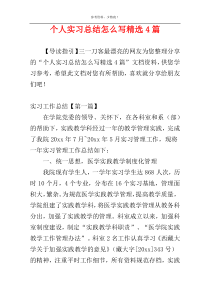 个人实习总结怎么写精选4篇